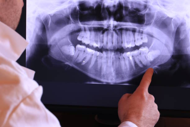 Best After-Hours Emergency Dentist in Cypress, CA